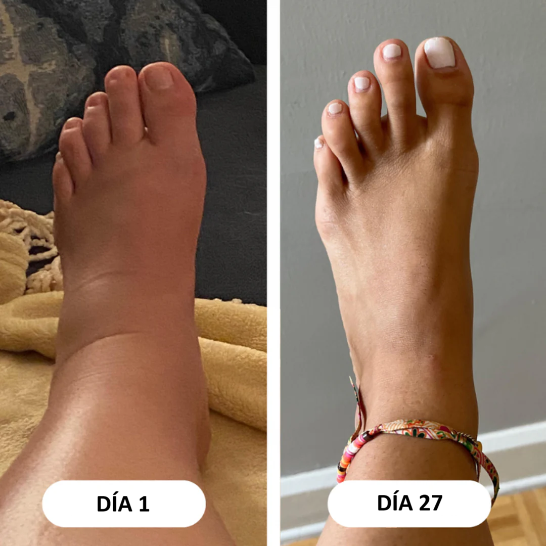 LÍVANA: Drena Naturalmente la Hinchazón del Rostro, Abdomen y Piernas