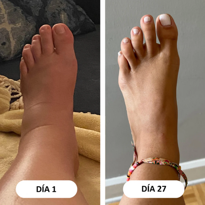 LÍVANA: Drena Naturalmente la Hinchazón del Rostro, Abdomen y Piernas